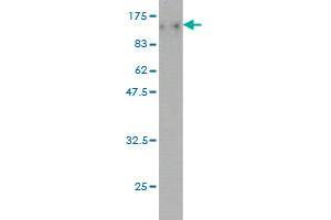 Western Blot detection against Immunogen (120. (TOP3B anticorps  (AA 1-862))