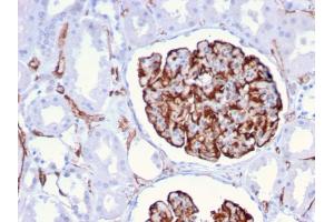 Formalin-fixed, paraffin-embedded human Kidney stained with Nestin Mouse Monoclonal Antibody (NES/2911).