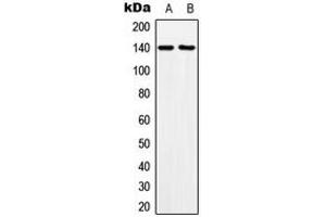 Western blot analysis of MOV10L1 expression in HeLa (A), NIH3T3 (B) whole cell lysates. (MOV10L1 anticorps  (Center))