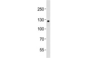 Western blot analysis of lysate from K562 cell line using LIFR antibody diluted at 1:1000. (LIFR anticorps  (C-Term))