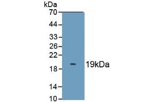 Detection of Recombinant S100A8, Cattle using Polyclonal Antibody to S100 Calcium Binding Protein A8 (S100A8) (S100A8 anticorps  (AA 1-89))