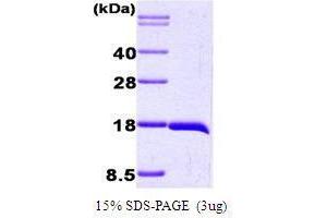 Figure annotation denotes ug of protein loaded and % gel used. (Interleukin 1, beta (IL1B) (AA 117-269) Peptide)