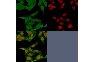 Immunofluorescence staining of HeLa cells using S100A4 Mouse Monoclonal Antibody (S100A4/1481) followed by goat anti-Mouse IgG conjugated to CF488 (green). (s100a4 anticorps  (AA 1-200))
