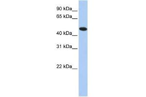 WB Suggested Anti-TXNDC5 Antibody Titration: 0. (TXNDC5 anticorps  (N-Term))