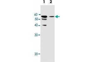 Western blot analysis of Lane 1: MCF-7 cell line lysates Lane 2: T47D cell line lysates reacted with ALDH6A1 monoclonal a tibody  at 1:1000 dilution.