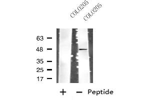 Western blot analysis of extracts from COLO205 cells, using CSF2RA antibody. (CSF2RA anticorps  (Internal Region))