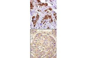 Image no. 2 for anti-Melanoma Antigen Family A, 4 (MAGEA4) (N-Term) antibody (ABIN358647) (MAGEA4 anticorps  (N-Term))