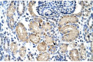 Rabbit Anti-ELL Antibody Catalog Number: ARP30105 Paraffin Embedded Tissue: Human Kidney Cellular Data: Epithelial cells of renal tubule Antibody Concentration: 4. (ELL anticorps  (C-Term))