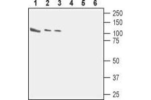 Western blot analysis of rat brain (lanes 1 and 4), mouse brain (lanes 2 and 5) and human neuroblastoma (SH-SY5Y) (lanes 3 and 6) cell line lysates: - 1,2.