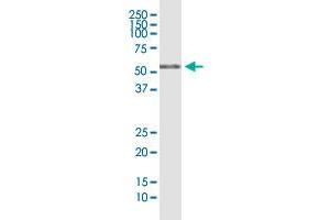 RIOK3 monoclonal antibody (M01), clone 4A12-1D2.