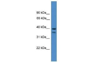 SERPINB6 antibody used at 0. (SERPINB6 anticorps  (Middle Region))