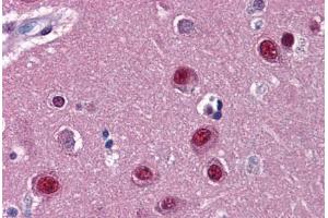 Human Brain, Cortex: Formalin-Fixed, Paraffin-Embedded (FFPE)