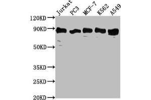 Western Blot Positive WB detected in: Jurkat whole cell lysate, PC3 whole cell lysate, MCF-7 whole cell lysate, K562 whole cell lysate, A549 whole cell lysate All lanes: BRAT1 antibody at 1:2000 Secondary Goat polyclonal to rabbit IgG at 1/50000 dilution Predicted band size: 89, 31, 32 kDa Observed band size: 89 kDa (BAAT1 anticorps  (AA 603-821))