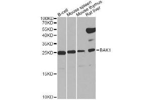 Western blot analysis of extracts of various cell lines, using BAK1 Antibody.