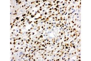 IHC-P: MPO antibody testing of human appendicitis tissue