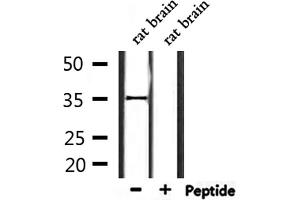 Western blot analysis of extracts from rat brain, using OR2L2 Antibody.