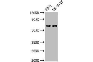 Western Blot Positive WB detected in: U251 whole cell lysate, SH-SY5Y whole cell lysate All lanes: Nox4 antibody at 3. (NADPH Oxidase 4 anticorps  (AA 210-424))