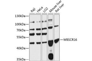 Western blot analysis of extracts of various cell lines, using WBSCR16 antibody (ABIN7271367) at 1:3000 dilution.