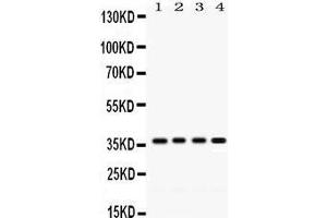 Western Blotting (WB) image for anti-Forkhead Box A3 (FOXA3) (AA 291-324), (C-Term) antibody (ABIN3042401) (FOXA3 anticorps  (C-Term))