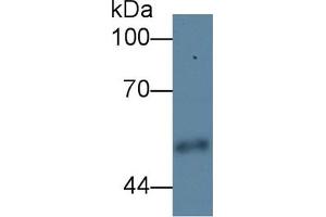 Detection antibody from the kit in WB with Positive Control:  Sample Human urine. (CPE Kit ELISA)