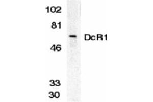 Image no. 1 for anti-Tumor Necrosis Factor Receptor Superfamily, Member 10c (TNFRSF10C) (Extracellular Domain) antibody (ABIN203554) (DcR1 anticorps  (Extracellular Domain))