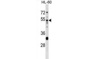 Western Blotting (WB) image for anti-Protease, serine, 16 (Thymus) (PRSS16) antibody (ABIN2998848) (PRSS16 anticorps)