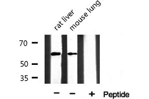 Western blot analysis of extracts of various tissue ,using Keratin 10 antibody.