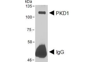 HEK293 lysate overexpressing Human DYKDDDDK-tagged PKD1 was used to immunoprecipitate PKD1 with 2ug Antibody.