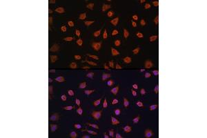 Immunofluorescence analysis of L929 cells using PFKFB2 Rabbit pAb (ABIN6129842, ABIN6145483, ABIN6145484 and ABIN6224971) at dilution of 1:100 (40x lens).
