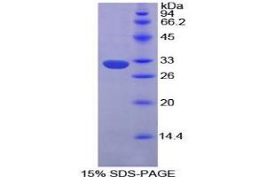 SDS-PAGE analysis of Mouse EPHA1 Protein. (EPHA1 Protéine)