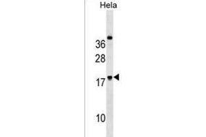 RN Antibody (Center) (ABIN1538629 and ABIN2850418) western blot analysis in Hela cell line lysates (35 μg/lane). (RNF224 anticorps  (AA 79-105))