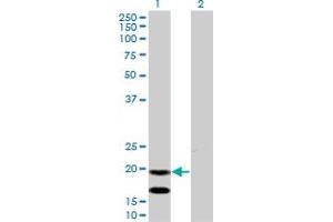 Western Blot analysis of EMP3 expression in transfected 293T cell line by EMP3 monoclonal antibody (M01), clone 3D4. (EMP3 anticorps  (AA 1-163))