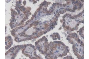 DAB staining on IHC-P; Samples: Human Thyroid Tissue (UXT anticorps  (AA 15-157))