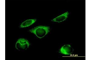 Immunofluorescence of purified MaxPab antibody to P4HB on HeLa cell. (P4HB anticorps  (AA 1-508))