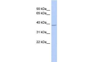 WB Suggested Anti-SOX7 Antibody Titration:  1 ug/ml  Positive Control:  Fetal Stomach cell lysate (SOX7 anticorps  (Middle Region))