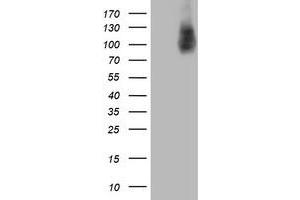 HEK293T cells were transfected with the pCMV6-ENTRY control (Left lane) or pCMV6-ENTRY HLCS (Right lane) cDNA for 48 hrs and lysed. (HLCS anticorps)