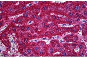 Human Liver: Formalin-Fixed, Paraffin-Embedded (FFPE)