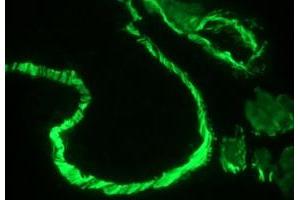 Image no. 3 for anti-Actin, alpha 1, Skeletal Muscle (ACTA1) antibody (ABIN1502284)