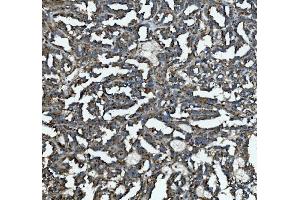 IHC analysis of GLB1/Beta-galactosidase using anti-GLB1/Beta-galactosidase antibody (ABIN7601806). (GLB1 anticorps  (AA 46-655))