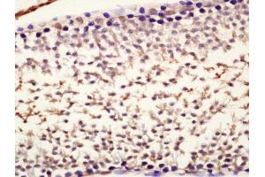 Formalin-fixed and paraffin embedded rat testis labeled with Anti-Nanog Polyclonal Antibody, Unconjugated (ABIN2177828) at 1:200 followed by conjugation to the secondary antibody and DAB staining