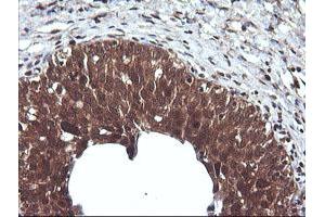 Image no. 6 for anti-Cancer/testis Antigen 1B (CTAG1B) antibody (ABIN1499895) (CTAG1B anticorps)