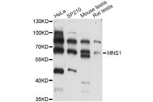 Western blot analysis of extracts of various cell lines, using MNS1 antibody (ABIN6293805) at 1:3000 dilution.