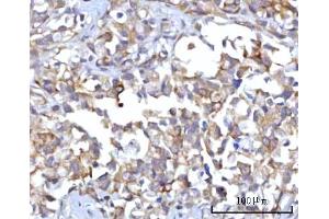 IHC analysis of RAP1GAP using anti-RAP1GAP antibody (ABIN7599729). (RAP1GAP anticorps  (AA 11-661))