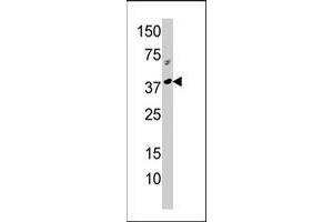 Western blot analysis of RCL1 polyclonal antibody  in A-375 cell line lysate (35 ug/lane). (RCL1 anticorps  (N-Term))