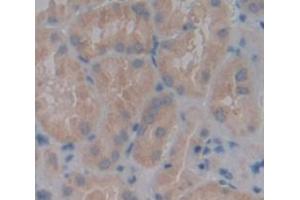 IHC-P analysis of Human Tissue, with DAB staining. (PAPPA2 anticorps  (AA 888-1093))