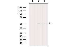 Western blot analysis of extracts from various samples, using BAGE5 Antibody. (BAGE5 anticorps)