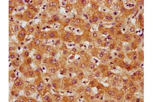 IHC image of ABIN7148683 diluted at 1:500 and staining in paraffin-embedded human liver tissue performed on a Leica BondTM system. (CRTC3 anticorps  (AA 373-480))