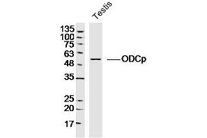 ADC anticorps  (AA 51-150)