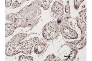 Immunoperoxidase of purified MaxPab antibody to ZNF584 on formalin-fixed paraffin-embedded human placenta. (ZNF584 anticorps  (AA 1-421))