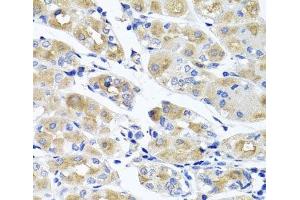 Immunohistochemistry of paraffin-embedded Human stomach using SPATA4 Polyclonal Antibody at dilution of 1:100 (40x lens). (SPATA4 anticorps)